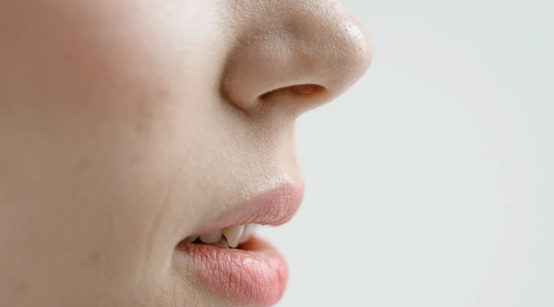 ポテンツァはいちご鼻に効果があるのか？