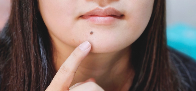 顎のほくろを指す女性