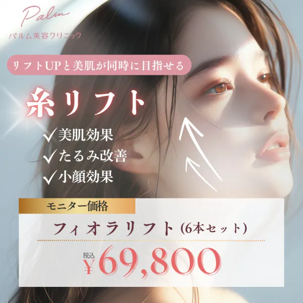 糸リフト